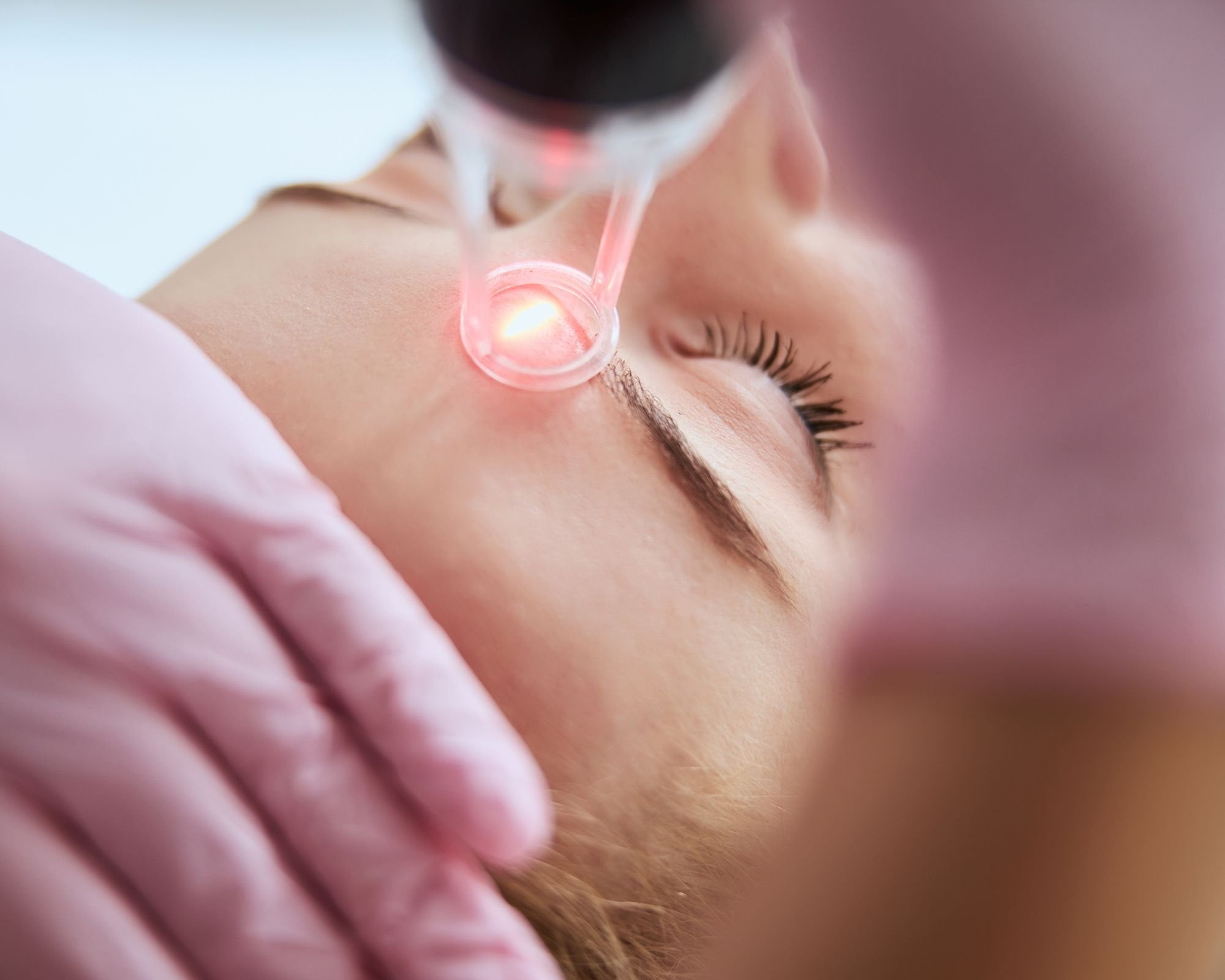 Pico Laser side effects